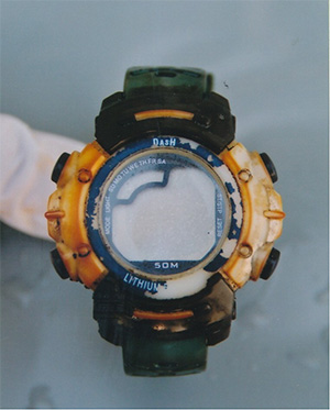 腕時計表側の写真