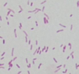 顕微鏡で見たレジオネラ属菌