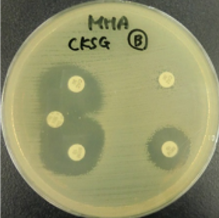 ディスク検査の写真