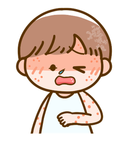 はしか（麻しん）イラスト