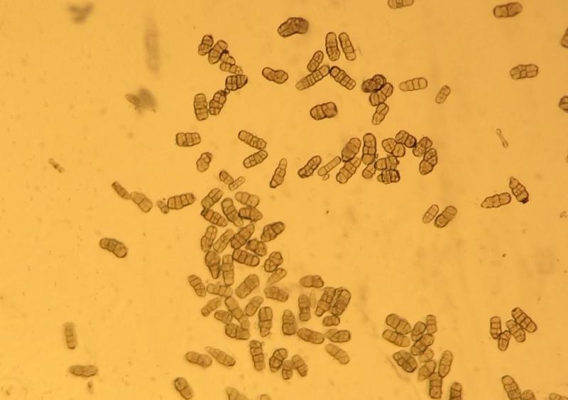 （参考）黒斑病菌によく似た病斑をつくる葉枯病菌（Stemphylium属菌）の分生子