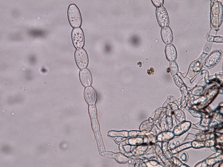 うどんこ病菌の分生子