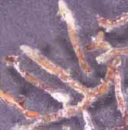 マツタケの外生菌根の実体顕微鏡写真