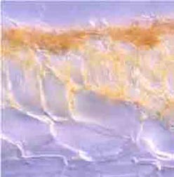 マツタケの外生菌根の光学顕微鏡写真